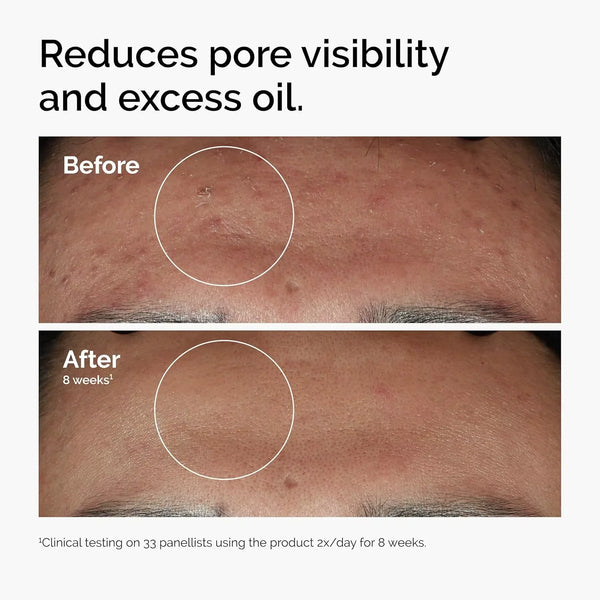 Glow-Boost Face Serum